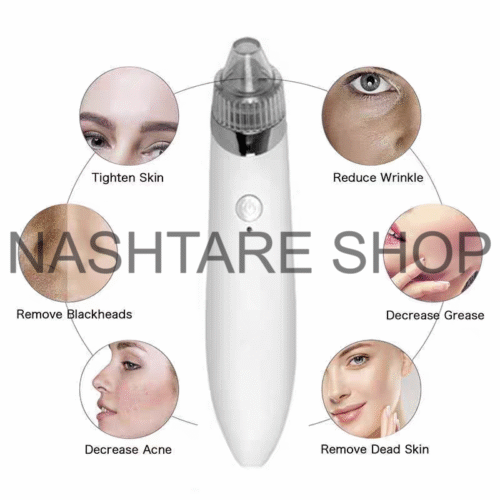 Electric Blackhead Remover | جهاز شفط و إزالة الرؤوس السوداء - Image 4